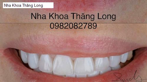 Hình ảnh Nha Khoa Thăng Long